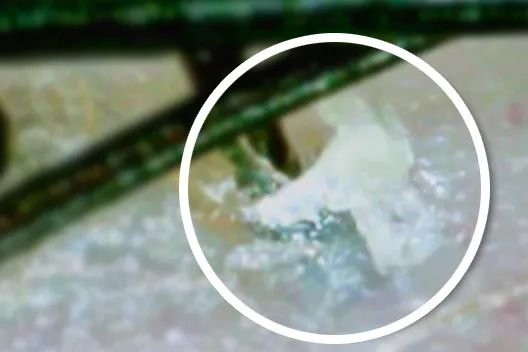 人间|叹头部SPA!拒做人间“油”物,解锁防秃养发小妙招!