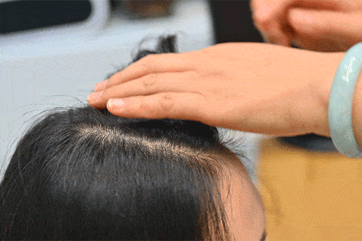 人间|叹头部SPA!拒做人间“油”物,解锁防秃养发小妙招!