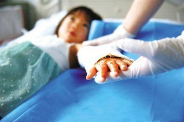 奶奶|奶奶冷静处理保住孩子双手，医生都点赞4岁孩子好奇伸手进油锅