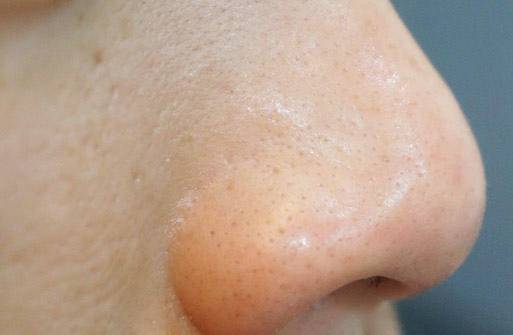 肌肤|别再跟风买了！油皮的【本命水】你喝对了吗？