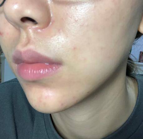 肌肤|别再跟风买了！油皮的【本命水】你喝对了吗？