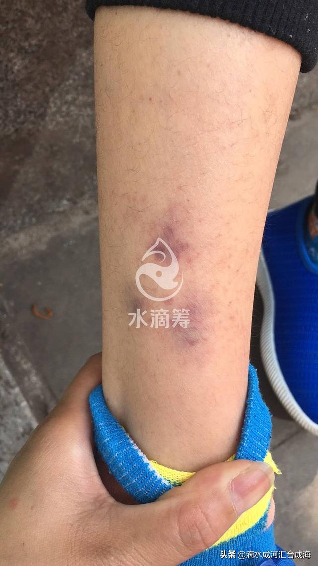 治疗|但已经掏空我的家庭10岁的孩子7个月都没有检查出病因