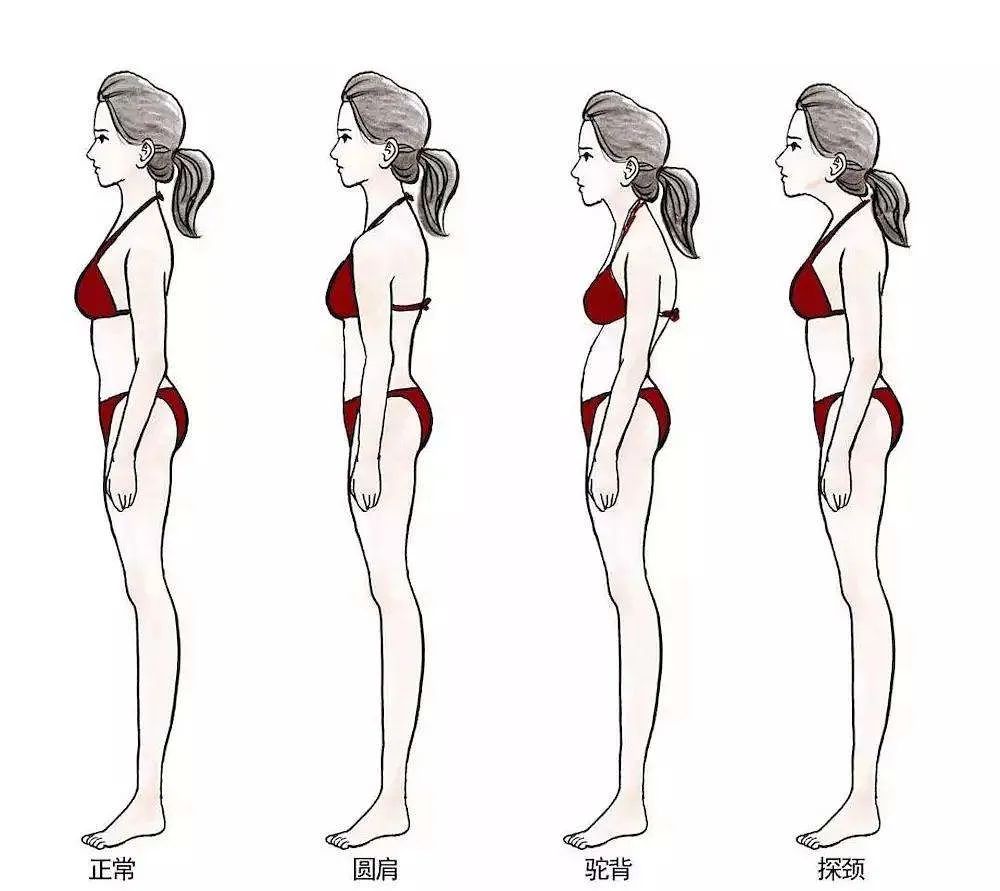 你真不是胖!改善这个体态问题,视觉上起码瘦10斤