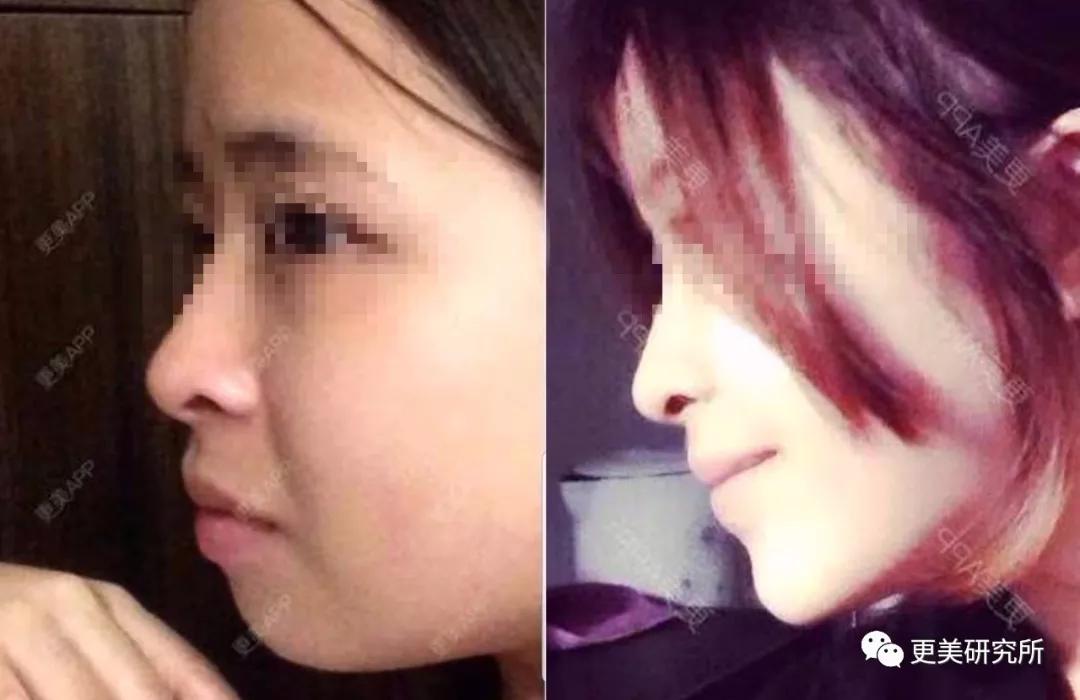 伸缩|蔡徐坤的下巴会自动伸缩？！这是do脸实锤了？