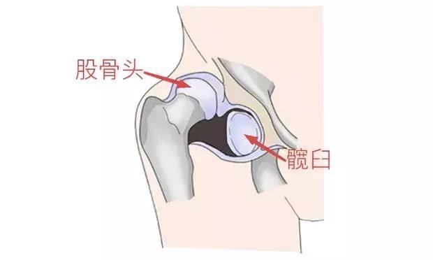 髋关节|宝宝腿纹不对称？1岁后发现就晚了