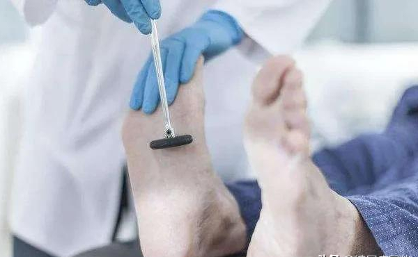 原创糖尿病烂脚发生前,身体有6个信号,早知道早预防 原创糖尿病烂脚发生前,身体有6个信号,早知道早预防