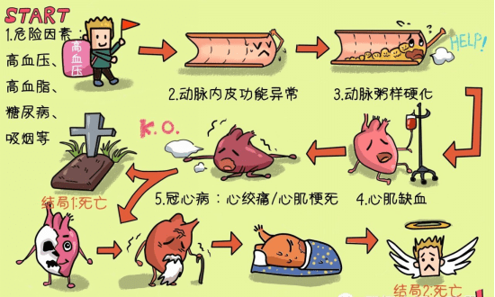 警惕人类健康的"头号杀手"——冠心病