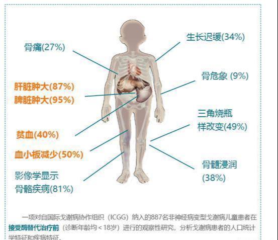 体内gdp缺乏_缺乏安全感图片