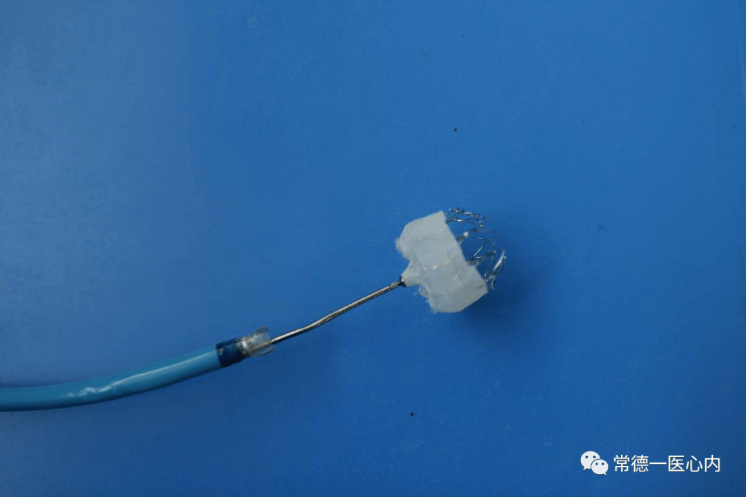 常德一医顺利完成房颤射频消融左心耳封堵一站式手术