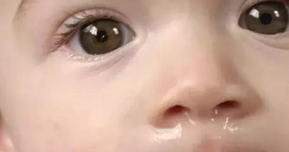 鼻涕|宝宝流鼻涕可不一定就是感冒! 四种不让宝宝流鼻涕的方法等你学~
