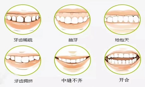 带完牙套反弹了怎么办