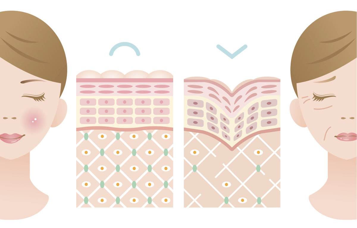 st筋膜再植,美容院热捧吸金抗衰项目