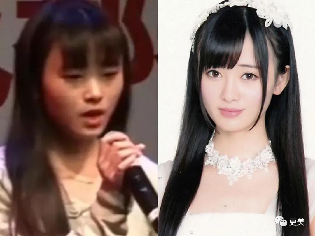 刘海|当毛发都在伪造的鞠婧祎失去刘海，场面瞬间窒息！