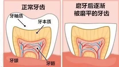 孩子|家长要注意！——湘曦源孩子睡觉磨牙不是小事