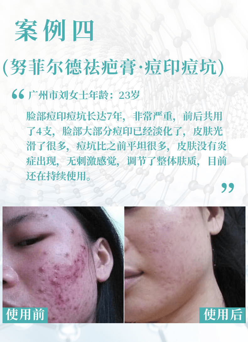 9e157575ebac4af28ffc19b9945dd2f2.png