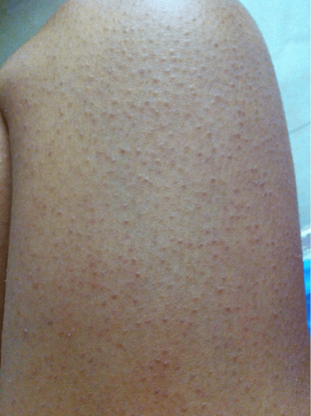 吃鸡皮肤怎么拿到 f2f472585af14e3a922d9de3c31ada71.png