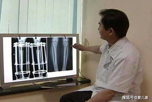 孩子|如今成了半残疾…这种「增高术」千万别给孩子做!当初花16万增高的孩子
