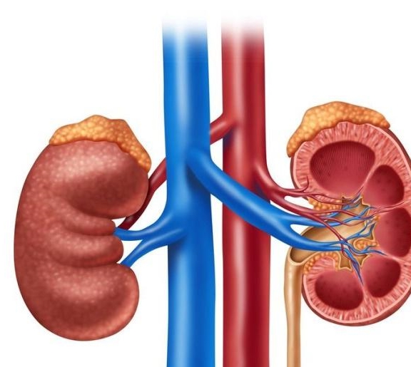 肾结石是怎样引起的啊 03a7d48cca374a7f9d7cffd327b6cf07.jpeg