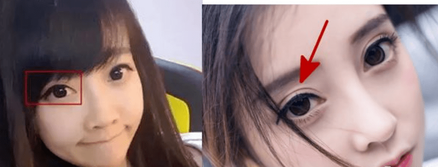 do|冯提莫这是后遗症出来了还是do了两次？搞成猪鼻子了…