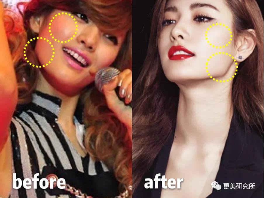 do|20年不崩的do圈C位,鞠婧祎baby都求她医生,堪称医学奇迹