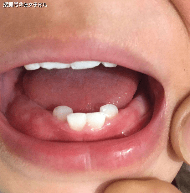 回事儿|乳牙还没长齐，怎么回事儿？可能有宝妈的错，别不信宝宝2岁了