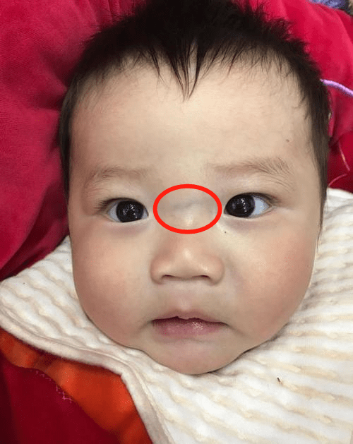 脾胃|“惨虐”孩子的脾胃，食欲差，父母须谨记孩子常吃这三种水果