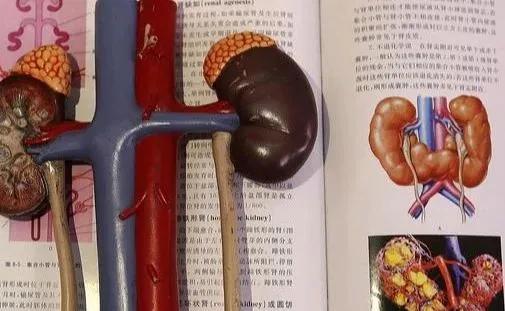 治疗|糖尿病人出现三个信号,是肾病发生了,这样做远离肾衰歇!