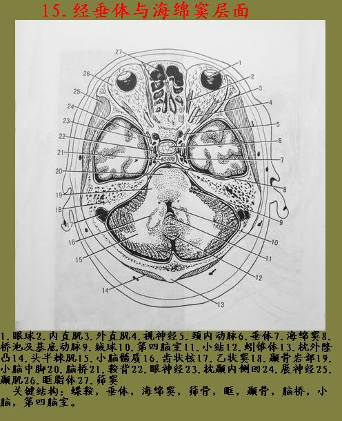 头部横断层解剖图谱线条图