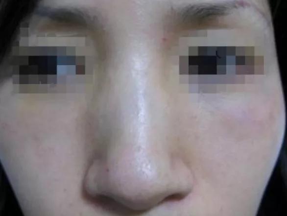 温岚|她都这么红了,到底还有什么执念非要N次换头成眯眼怪啊?