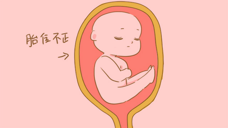 孩子|责任竟然大多在家长揭秘孩子罗圈腿的4大形成原因