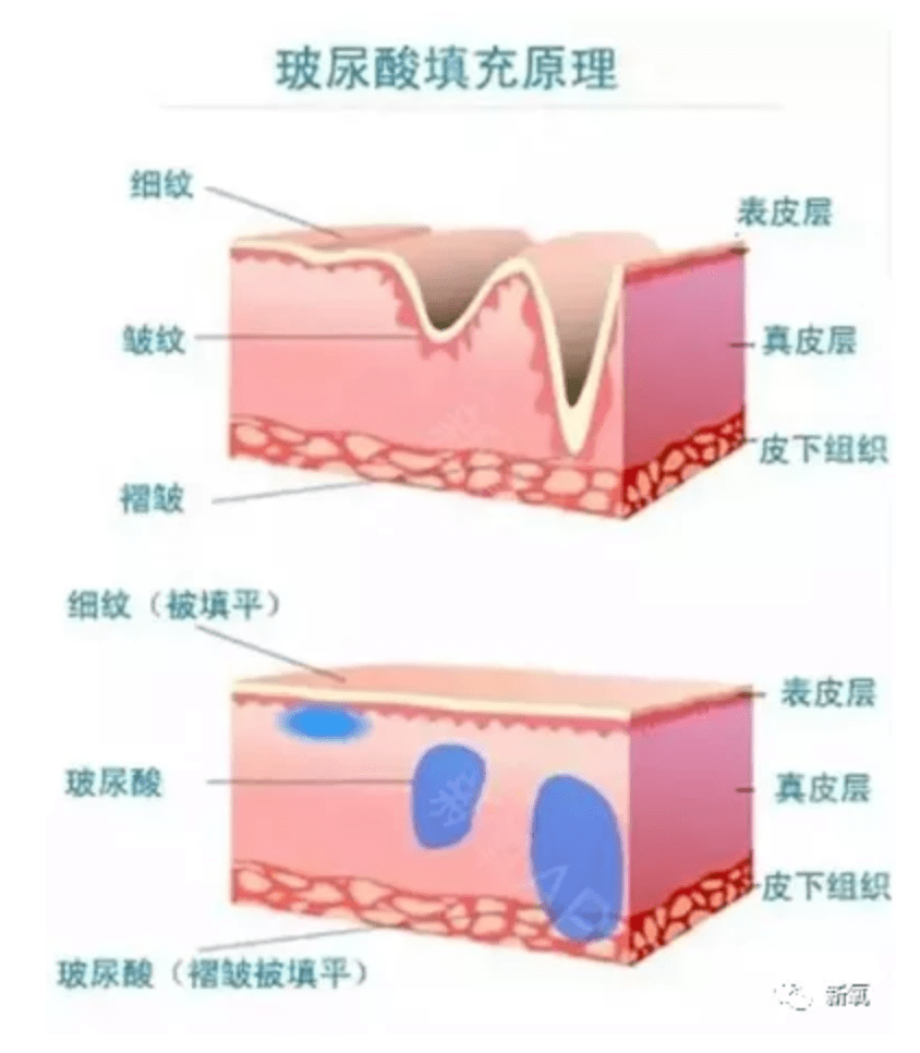 少女|她也太会搞了!自创精灵女王脸秒杀各种小花,哪个直男扛得住?