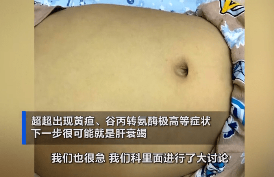 小黄人|差点急性肝衰竭，外公：一天一杯酒8岁男孩突然变成“小黄人”