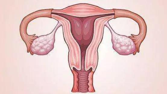 认识子宫畸形对怀孕的影响之双角子宫