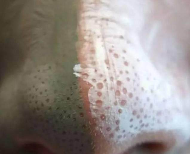 什么办法可以快速除螨 8ae6e5f25e4f4a2a8842e3358c58a88e.jpeg