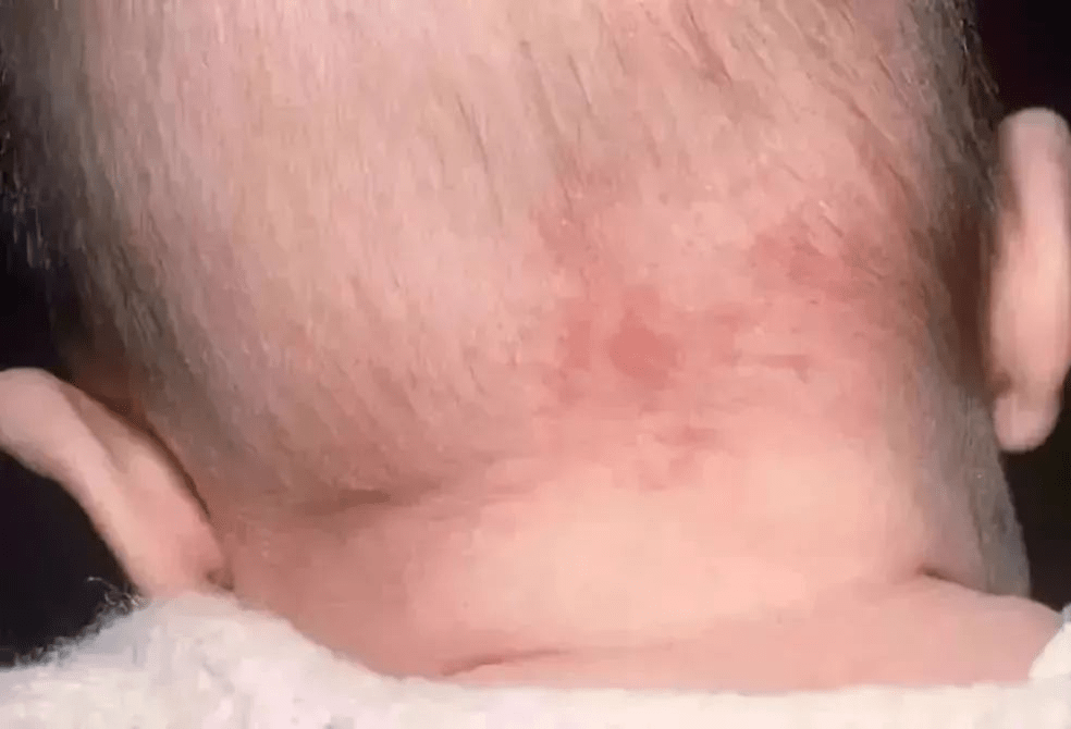 同款|定制同款胎记纹身贴纸，网友：最酷的纹身暖心！爸爸怕儿子自卑