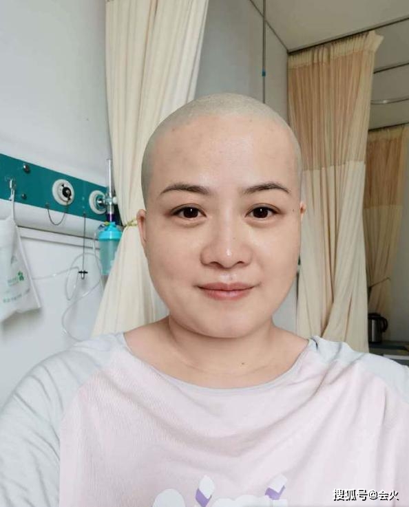 茶艺|原创岳云鹏老婆生病后首晒照，利落短发双眼肿胀憔悴，身形也消瘦不少