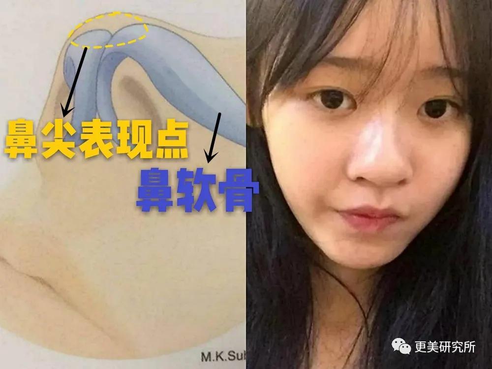鼻尖|杨幂终于去修复鼻子了…