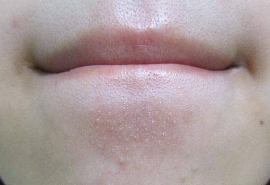 按摩|别整些没用的!谁说长期化妆皮肤就会变差?