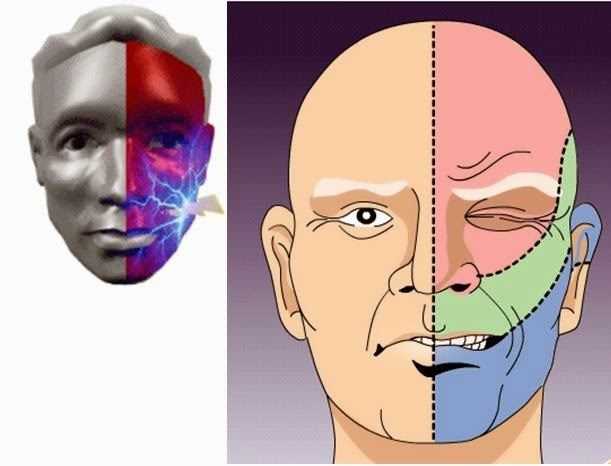 怎样才能有效的治疗三叉神经痛 63993cf6195f42149fbd163513886124.jpeg