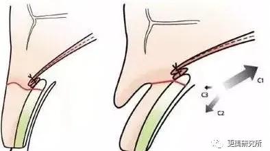 郭碧婷|比奚梦瑶、郭碧婷都惨的“豪门弃妇”，43岁颜值回春、好会do！