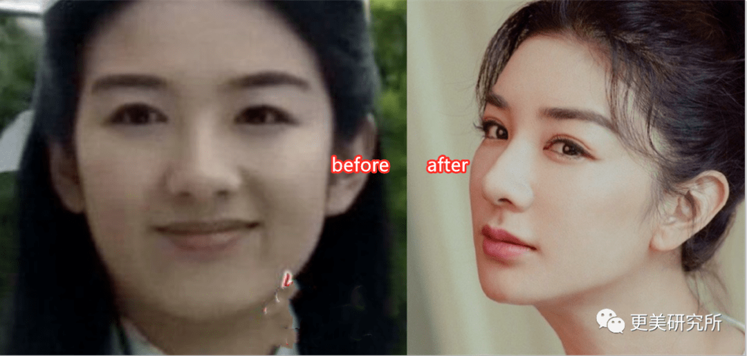 郭碧婷|比奚梦瑶、郭碧婷都惨的“豪门弃妇”，43岁颜值回春、好会do！