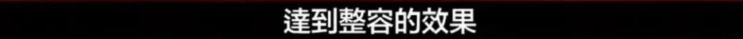 全网|才没红几天,她的整前脸就被全网扒光了…