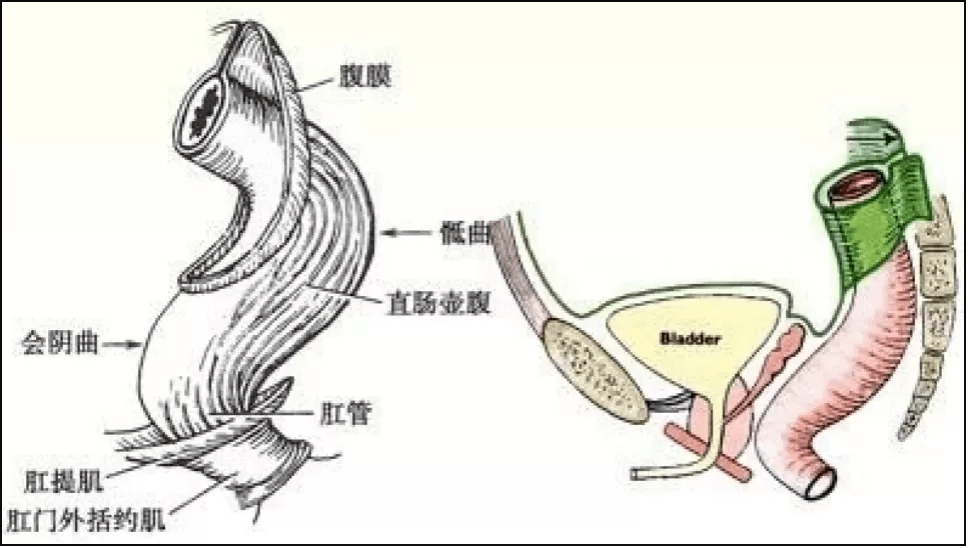 当异物进入后随着疼痛的刺激和肛门括约肌的收缩便会导致异物难以拿出