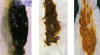 爸妈|不解其中意“一睡二哭三攒肚”到底什么含义？新手爸妈别光会说