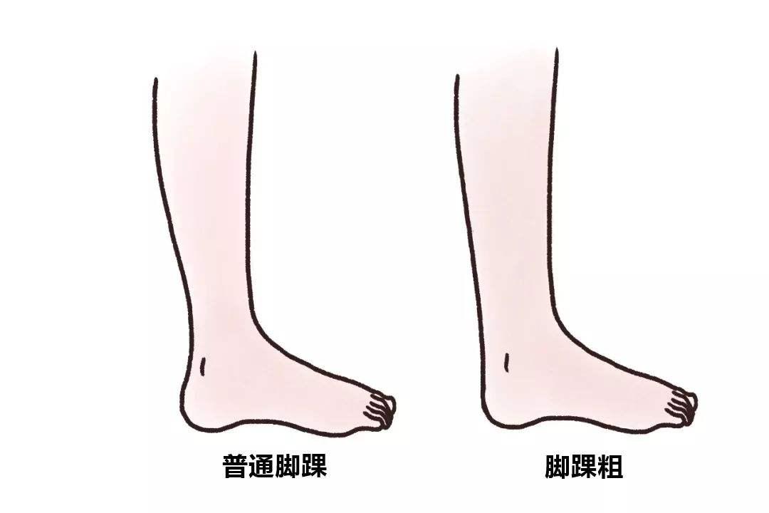 没有"脚腕"的女生,不要乱买衣服,这些裤子和鞋穿了才显瘦