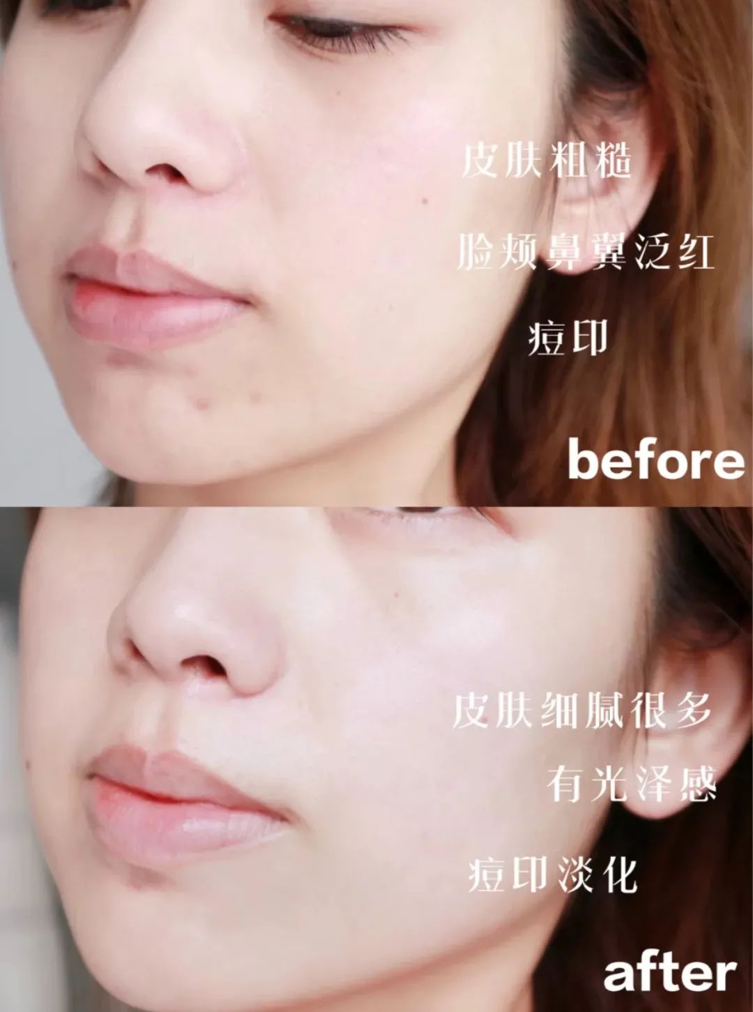 皮肤|秋冬换季护肤大作战