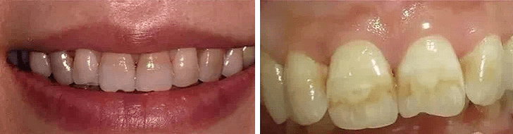 新剧|她新剧开撩，吻戏也就回放 10 来遍吧