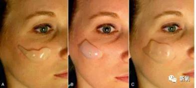 西方|东西方顶级神颜都共用同一张脸?