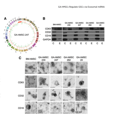 通过westernblot及透射电镜,粒径等实验结果发现检测到ga-hmsc外泌体