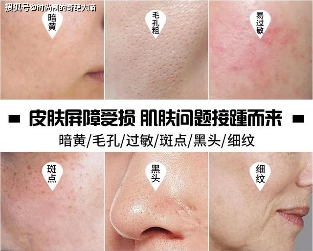 什么|李多海的脸遭遇了什么!坑坑洼洼粉都填不平,没了滤镜颜值太真实